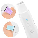 Peeling Ultrassônico Limpador Facial - Renovação e Rejuvenescimento da Pele Sem Dor - Entrega de 4/5 dias