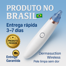 Removedor de Cravos a Vácuo Sem Fio - Limpeza Profunda e Cuidados com a Pele