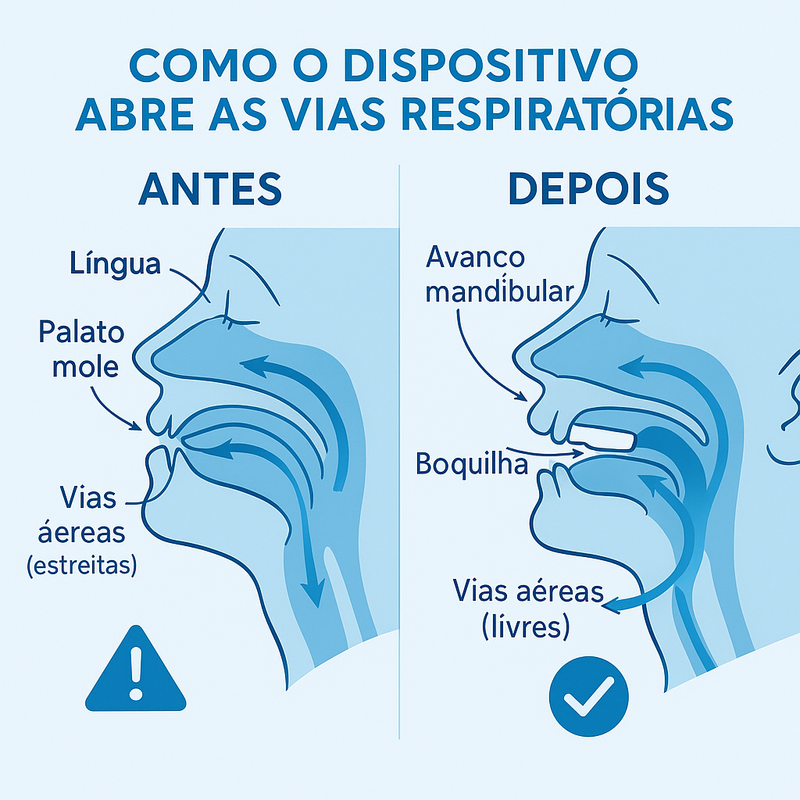 Boquilha de Conforto Noturno 2-em-1 – Ajuste e Bem-Estar ao Dormir